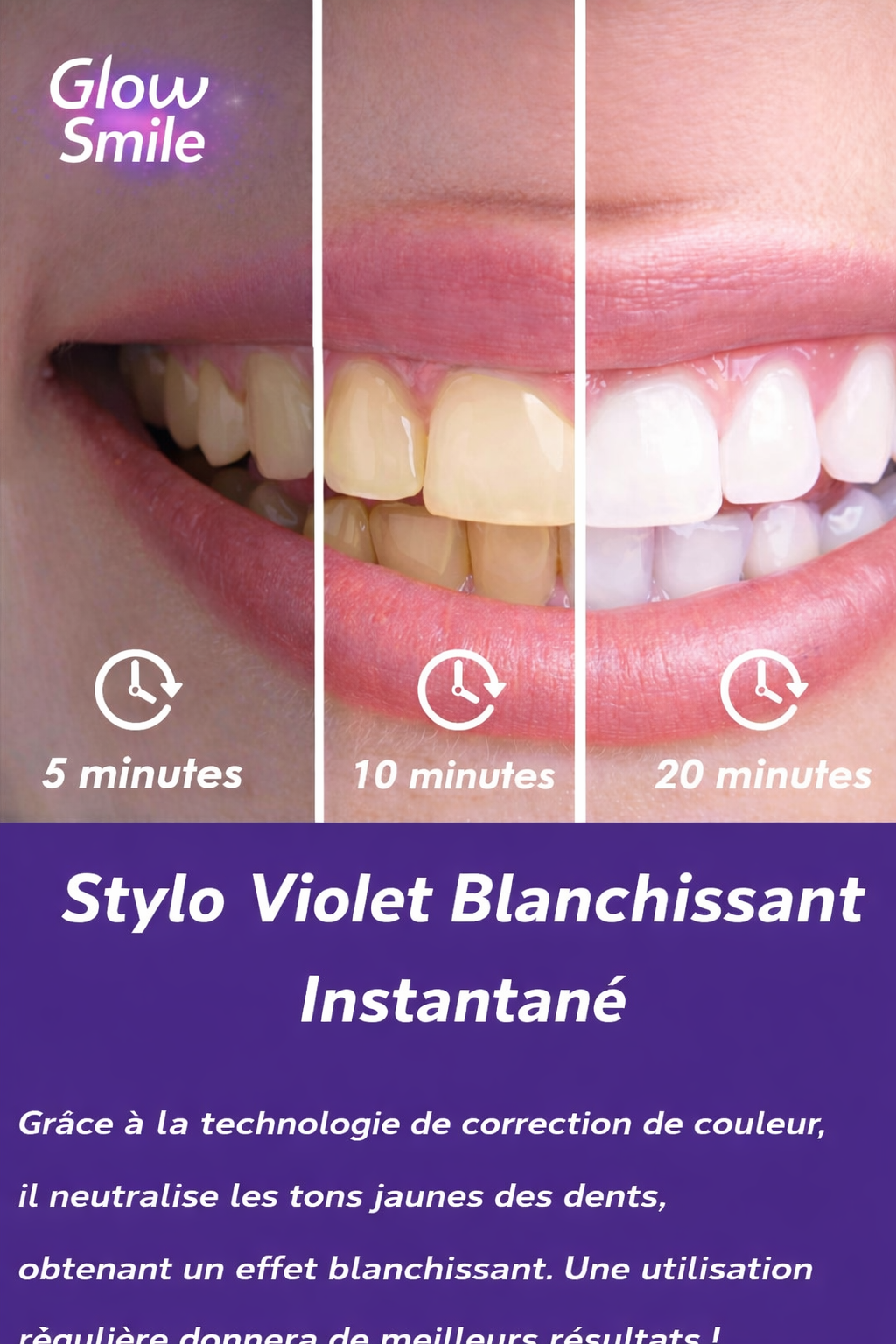 Stylo Blanchissant Violet Instantané – Glow Smile